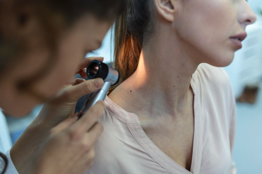 Are Skin Tags Dangerous? See a Hyderabad Dermatologist